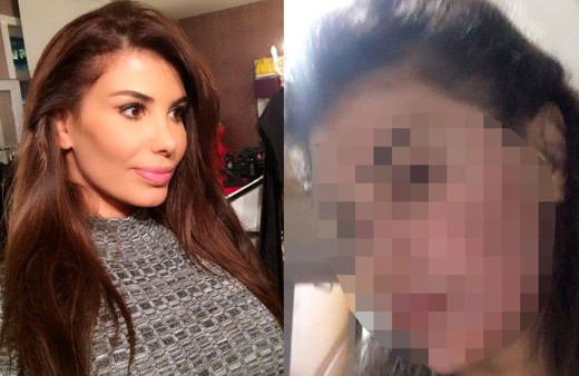 Şarkıcı Hatice'nin yüzü yandı son halini görenler tanımakta güçlük çekti