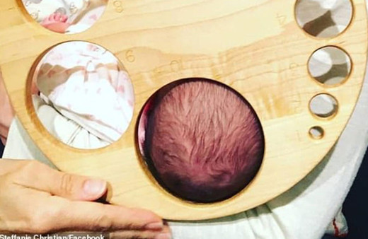 Doğumda rahim ne kadar genişliyor? Sosyal medyada viral olan fotoğraf!