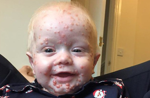 Su çiçeği çıkarıyor sandılar doktora gidince gerçek ortaya çıktı