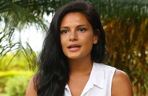 Survivor Almeda'nın inanılmaz değişimi! Estetikle bambaşka birine dönüştü