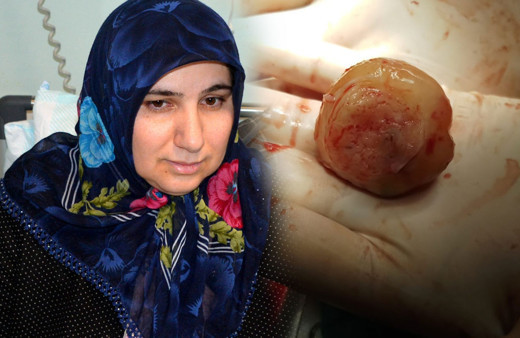 Baş dönmesi nedeniyle hastaneye gitti kalbinden çıkanlar şaşkına çevirdi