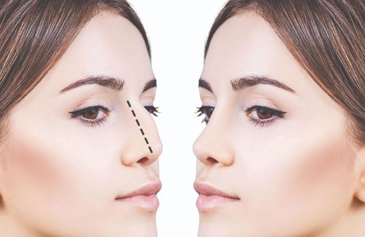 Burun dolgusu nedir zararları var mıdır?