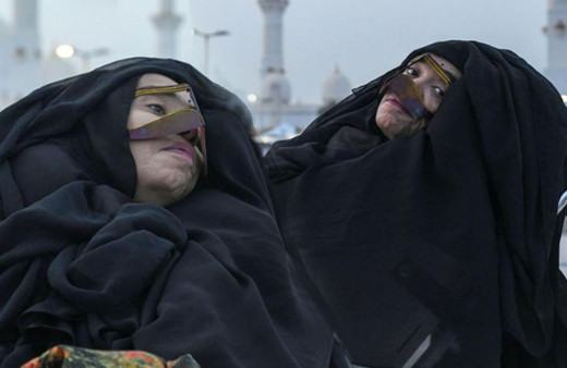 Tıp tarihinde bir ilk 32 yaşında girdiği komadan 59 yaşında uyandı!