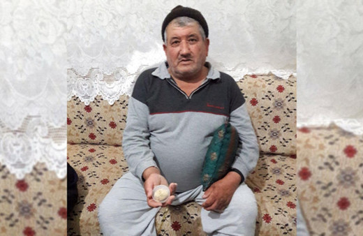 Mesanesinden çıkan doktorları bile şoke etti! Tam 300 gr ve...