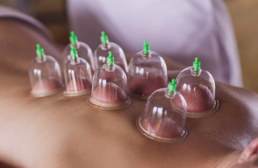 Hacamat hangi günler yapılmaz adetken hacamat olur mu?