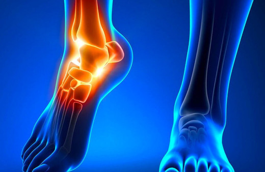 Kemikleri güçlendiren besinler nelerdir?