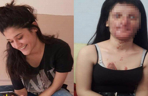 Hatay'da nişanlısının saldırdığı Berfin için kampanya