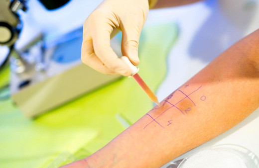 Deri testi nasıl yapılır bahar alerjisinden korunmanın yöntemi