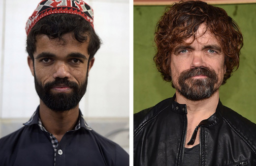 Game of Thrones'un efsane yıldızının ikizi görenleri şaşkına çeviriyor