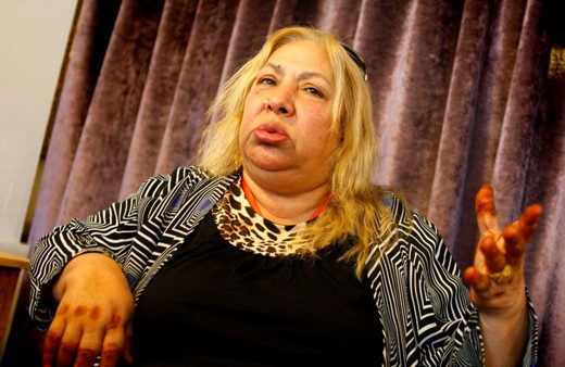 Dilber Ay'ın asıl ölüm nedeni ortaya çıktı! Herkes kalp krizi sanıyordu