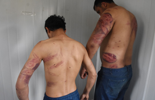 Yunan polisi Pakistanlı göçmenleri dövüp Türkiye'ye gönderdi