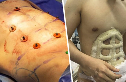 Erkeklerde yeni moda: Ameliyatla baklava yaptırıyor!