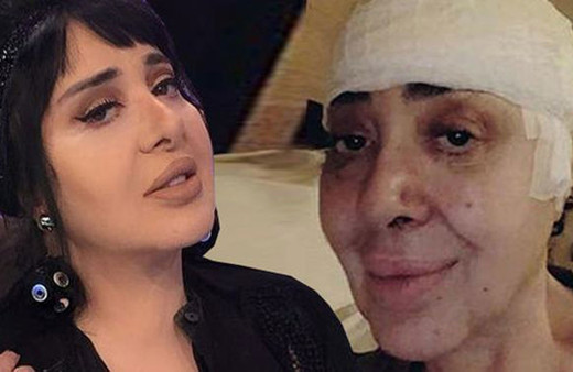 Nur Yerlitaş, sağlık durumunu canlı yayında anlattı