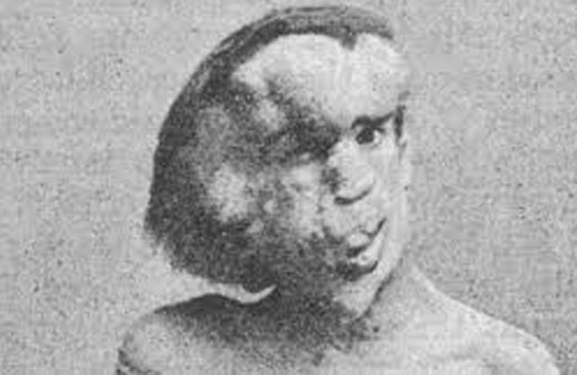 Fil Adam Joseph Merrick'in mezarının bulunduğu iddia edildi