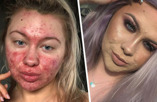 Genç kızın acı dramı günde 2 saatini makyaja harcıyor! İşte sebebi