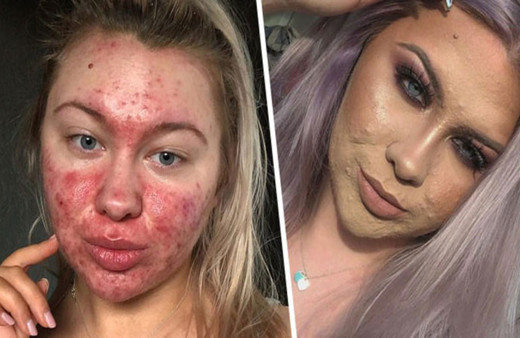 Her 2 gün saat boyunca makyaj yapıyor! Nedeni ise çok şaşırtıcı