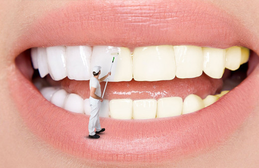 Diş beyazlatmak kanser yapar mı? Uzmanlar net konuştu