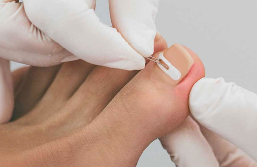 Uzmanlardan dikkat çeken tırnak bakımı uyarısı geldi