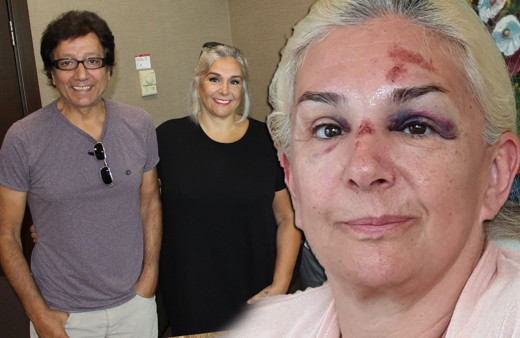 Burçin Orhon tanınmaz hale geldi Süheyl Uygur'un eşinin son görüntüsü korkunç