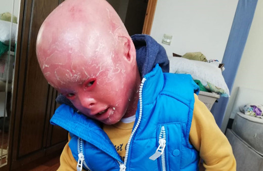 Balık pulu hastası Mehmet Emir'e Haluk Levent'ten büyük destek!