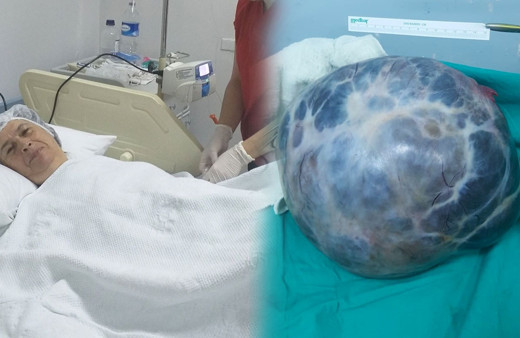 Kabızlık sandı ama gerçek bambaşka çıktı! Karnından alınanlara bakın