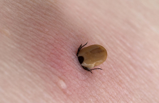 Kene nasıl çıkartılır kene ısırığı ölümle mi sonuçlanır?