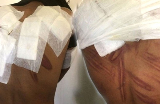 Plastik mermi elektrikli şok cihazları.... Dövüp Meriç Nehri'ne attılar!