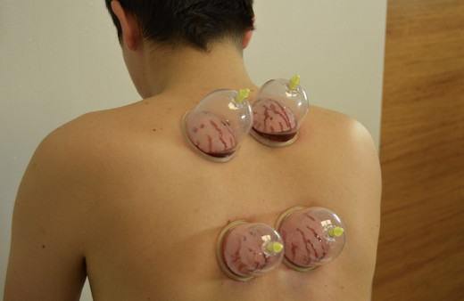 Hacamat yaptırma takvimi 2019 Haziran hangi günler yapılır?