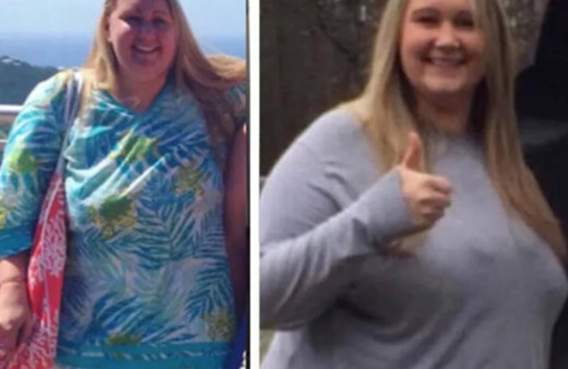 70 yaşında gibi hissediyordu! Onu bir de şimdi görün Son hali fena