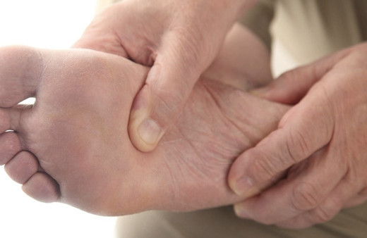 Ayakta mantar neden olur nasıl geçer evde tedavisi var mı?