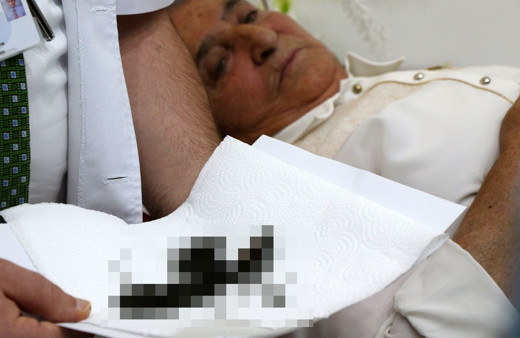 Yaşlı kadının safra kesesinden 450 tane taş çıktı