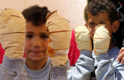 Küçük çocuğu yemek bile yiyemeyecek hale getirdi