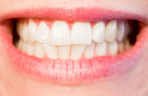 Uzmanlardan diş protezini çamaşır suyunda bekletenlere uyarı geldi