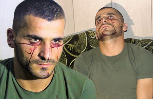 Iraklı genç kan ağlıyor! Hastalığına çare bulunamadı Türkiye'den yardım istedi