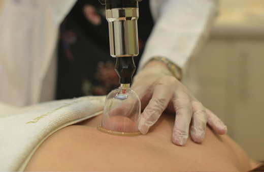 Hacamat takvimi 2022 Şubat hangi günler hacamat yapılır?