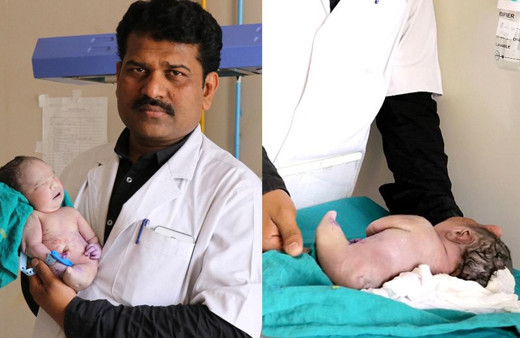 Hindistan'da doğan garip bebek doktorlar cinsiyetini tespit edemedi