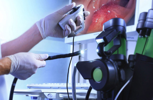 Uzmanından 'endoskopi' uyarısı! Kritik yaş ne