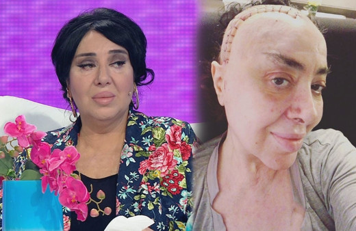 Beyin kanseri teşhisi konan Nur Yerlitaş'a bir fotoğraf paylaşınca mesaj yağdı