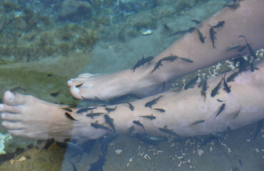 Sivas'ta doktor balıklar romatizma ve sedefe derman dünyada eşi yok