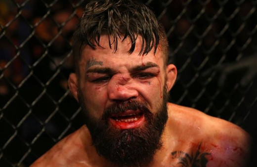 Mike Perry'nin burnu kırıldı suratı tanınmaz hale geldi