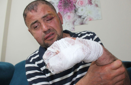 Bursa'da gazimizi öldüresiye darp eden 3 kişi hakkında yeni gelişme! Hak yerini buldu