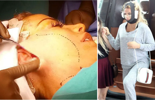 İngiliz şarkıcı Katie Price estetik ameliyatını canlı yayınladı! Sonrası ise korkunç