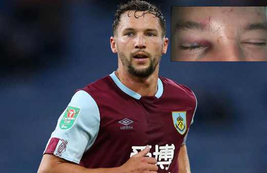 Danny Drinkwater'a çete saldırdı! Biri "Bacaklarını kırın" diyerek talmat verdi