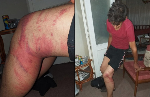 Konya'da çırağını triger kayışıyla döven usta tutuklandı