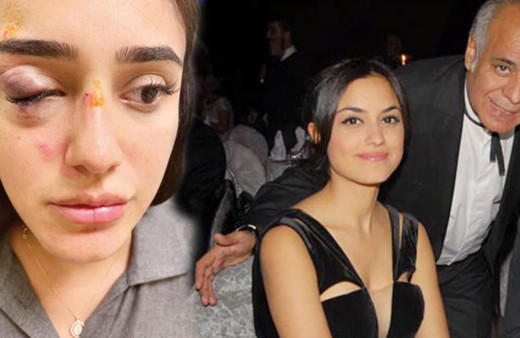 Rafet El Roman'ın eski eşi Ceren'in yüzü gözü patlamış! Baba Atilla Kaplakarslan tüm sırları ortaya döktü