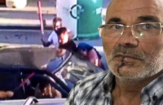 Yer Pendik! Kayınpederinin dudaklarını ısırarak kopardı resmen sokak savaşı