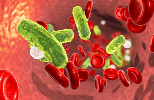 Sepsis hastalığı nedir? Belirtileri önemli yılda 8 milyon kişiyi öldürüyor