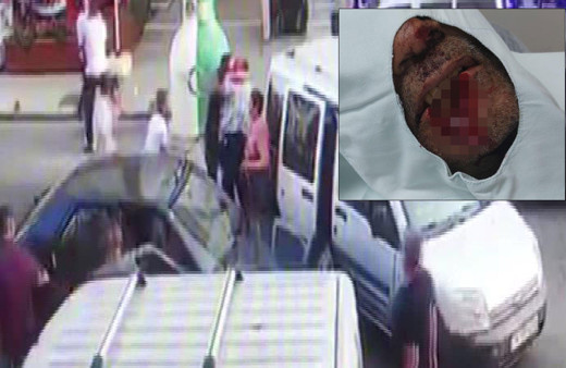 Pendik'te ısırarak kayınpederinin dudağını parçalayan damat tutuklandı