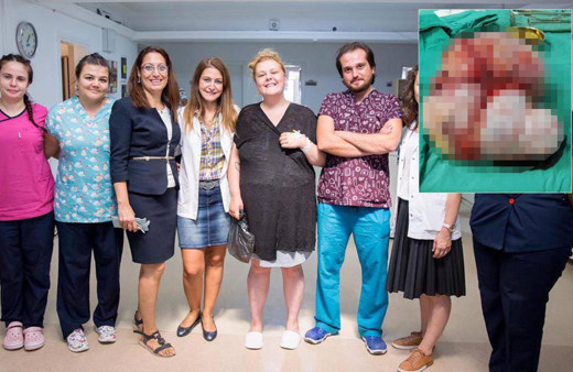 20 yaşındaki İngiliz turistin yumurtalıklarından 10 kilo kist çıktı