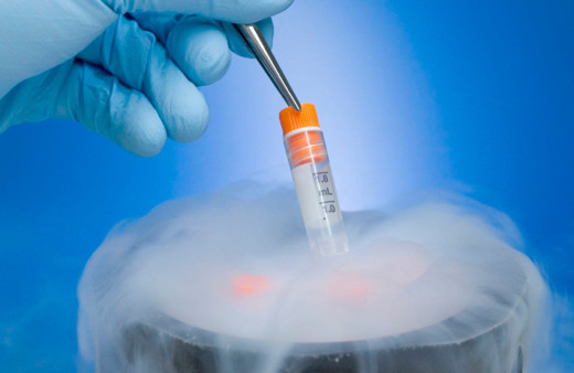 Tüp bebekte yumurta nasıl toplanır ağrı mı özel bir diyet var mı?